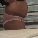 Before surgery