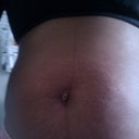Before surgery