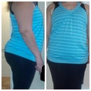 Taken 3/16/13.  I will be taking a picture after my surgery with these same clothes to compare.