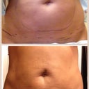 Day 24 before & after. I just wish my skin would shrink!!