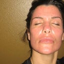 Day 6- pretty red and blotchy...no makeup