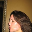 Day 6- Left side of face appears to be healing better