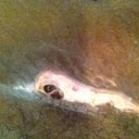 hole in my incision.