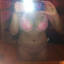 post op 5 days -bloated and swollen but still happy with what I see
