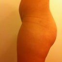 after (2 months)- no change. before photos i havent uploaded yet!