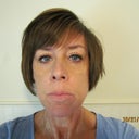 Three months after surgery.