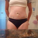 day 6 post op