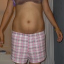 months prior to the operation