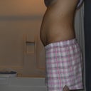 months prior to the operation