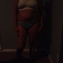 My front side before surgery - I had a TT 10 yrs ago and 2 more pregnancys later