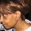 one year after my lifelift.