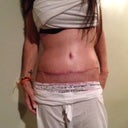 okay got drain and sutures out 3 days ago