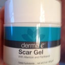 This is the scar cream my PS recommended.