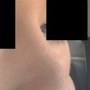 this is me at 6.5 months - I still think it is quite swollen??!