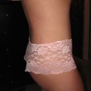 Post TT Side 5 Weeks