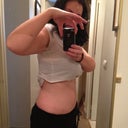 Side view 8 weeks post FTT