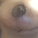 Shy 3 weeks post op