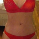 4 months post op. Looking very nice!!!