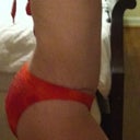 4 months. Left side. Scar shows a little on this side. Can't wait for it to fade. But I am still really happy!