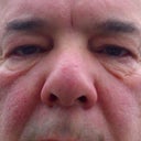 pre