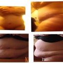 before and after