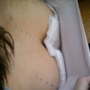 Few hours after surgery, inside look. They look yummy!!!!!!! hahaa