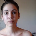 6 months post op