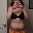 2 days after lipo