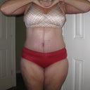 28 dpo Front view