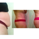 Before         4 weeks       7 weeks