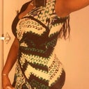 1 month post-opt with garment on (last yr)
