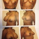 Official before and after