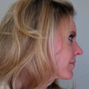 Side After