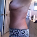 8 months post