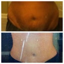 Before/ 2 months