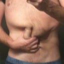 PRE OP - Scrunched