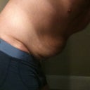 Pre Op - Side Bent Over and Relaxed