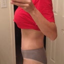 8.5 weeks post op, first thing in the morning