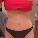 Bikini bottoms I already had. I have to pull them up a bit high to get them to cover the scar, but still - totally doable