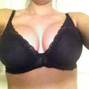 Day 18 after surgery with bra