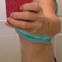 post op 8 weeks - middle incision still a bit of a problem
