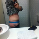 Week 3 - day after seroma drained