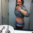 Week 3 - day after seroma drained