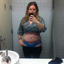 Week 3 - day after seroma drained