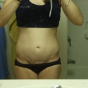 1 month post operation(some looseness in skin remains, but did not make sense to have a full-tummy tuck pre babies)

PM Photo