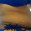 sitting side view WTF is this? Swelling, really!? 17 days PO