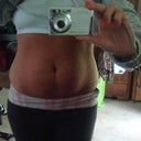 this is me ..10 days before surgery