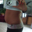 side view 10 days before surgery