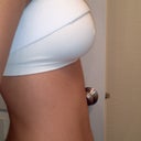 DAY 10 PO: Bloatiness is almost gone and back to light workout :) Right view: 325cc