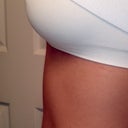 DAY 10 PO: Left view 300cc